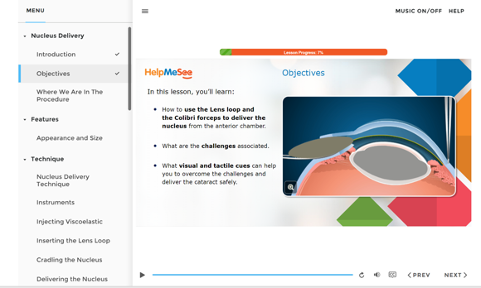 Virtual Learning for Cataract Surgery Simulator Proficiency